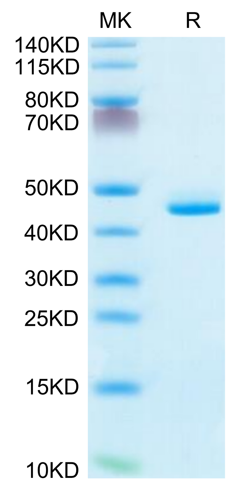 Human CD5L on Tris-Bis PAGE under reduced condition. The purity is greater than 95%.Recombinant Human CD5L Protein