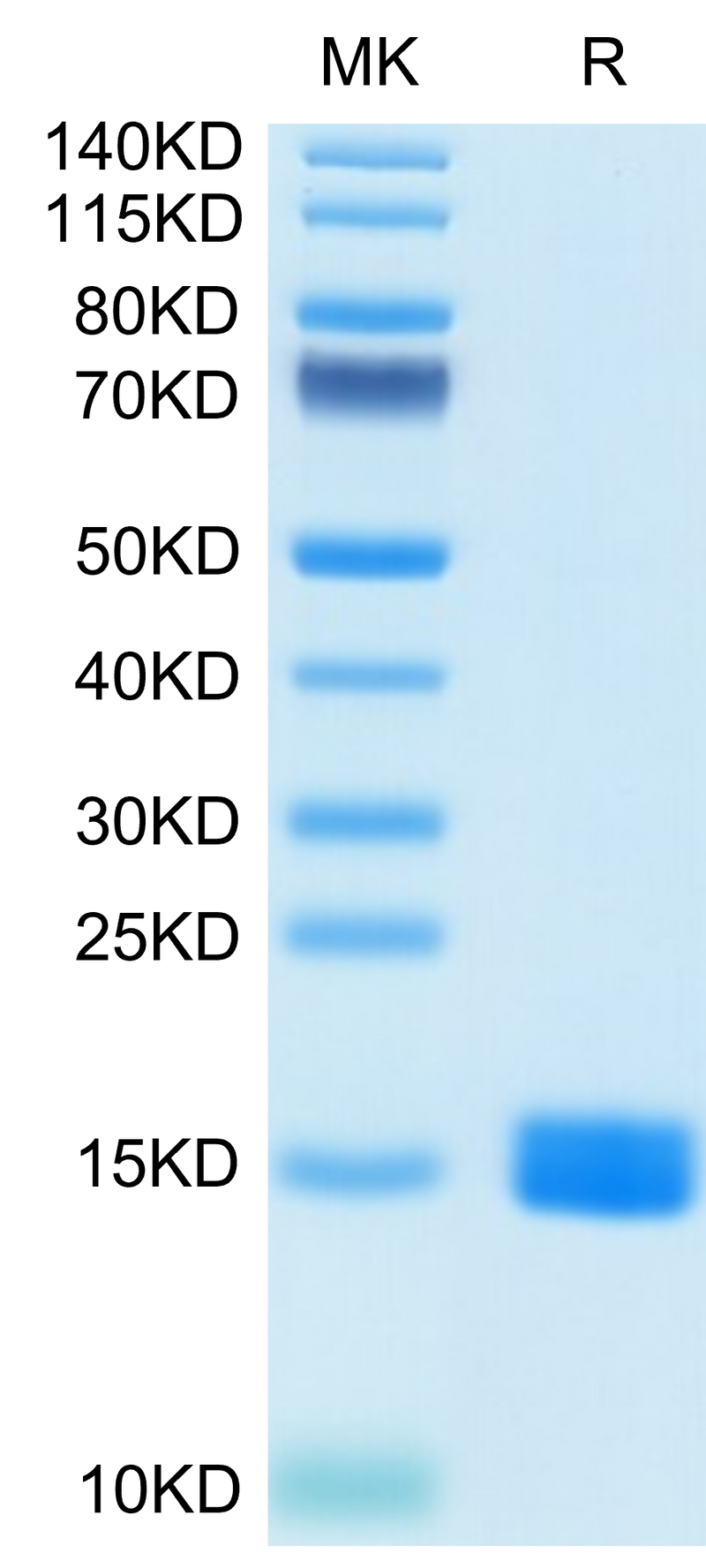 Human MARCO on Tris-Bis PAGE under reduced condition. The purity is greater than 95%.Recombinant Human MARCO Protein