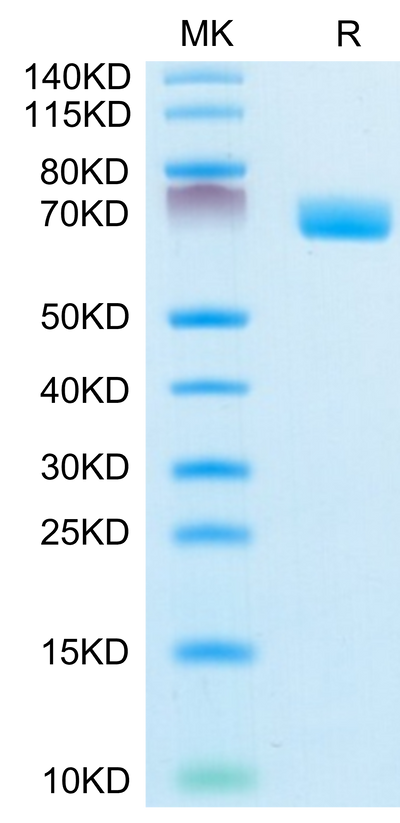 Mouse EPHA4 on Tris-Bis PAGE under reduced condition. The purity is greater than 95%.Recombinant Mouse EPHA4 Protein