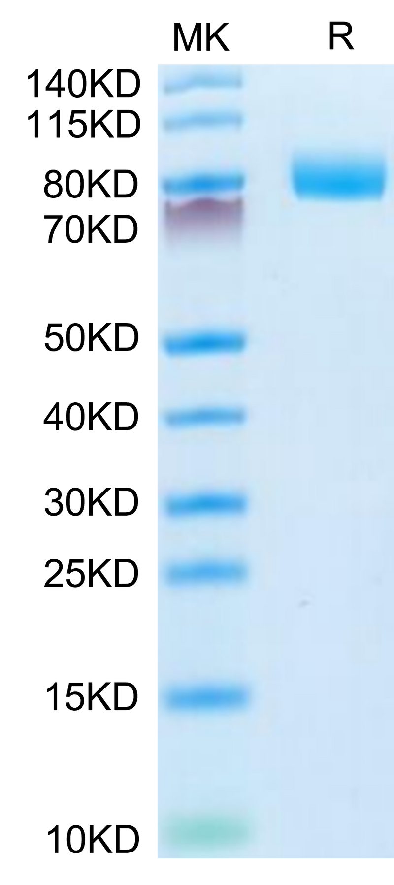 Mouse CD10 on Tris-Bis PAGE under reduced condition. The purity is greater than 95%.Recombinant Mouse CD10/MME Protein