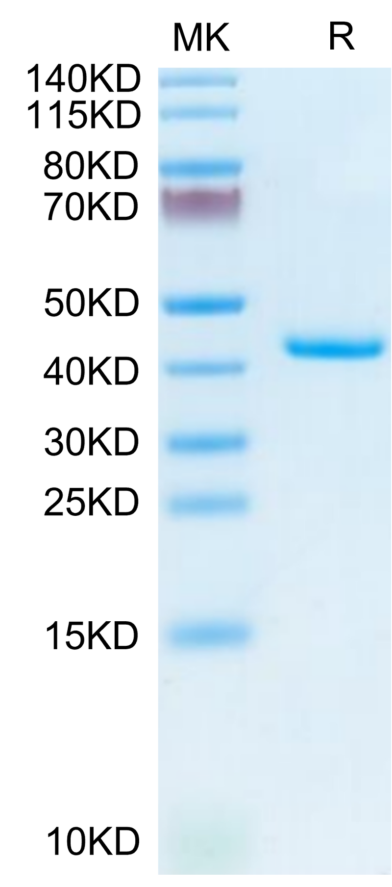 Mouse TNFRSF12A on Tris-Bis PAGE under reduced condition. The purity is greater than 95%.