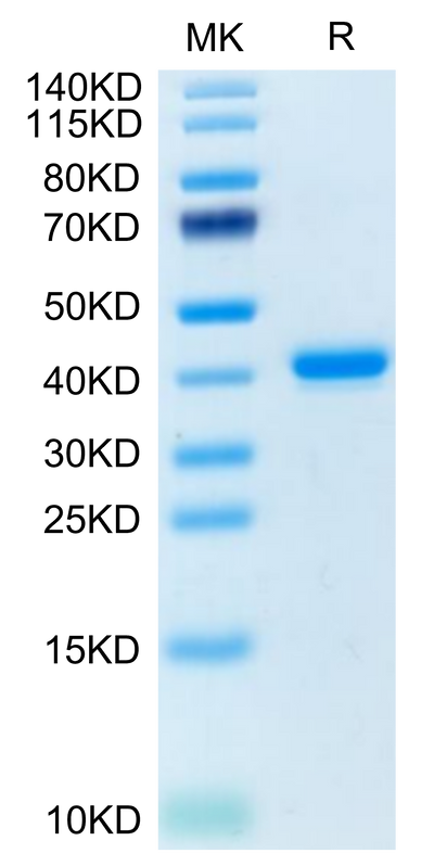 Human TNFRSF12A on Tris-Bis PAGE under reduced condition. The purity is greater than 95%.Recombinant Human TNFRSF12A/TWEAKR Protein, Active