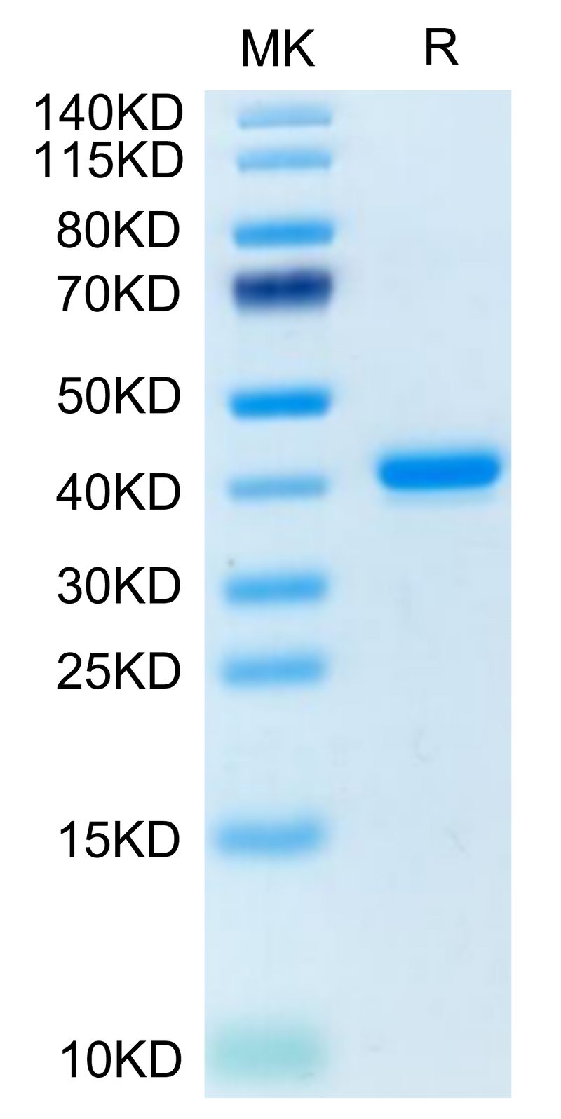 Human TNFRSF12A on Tris-Bis PAGE under reduced condition. The purity is greater than 95%.Recombinant Human TNFRSF12A/TWEAKR Protein, Active