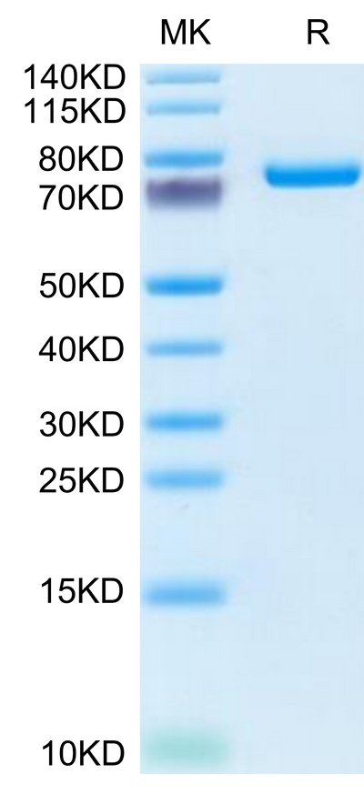 Mouse SEMA7A on Tris-Bis PAGE under reduced condition. The purity is greater than 95%.Recombinant Mouse SEMA7A Protein