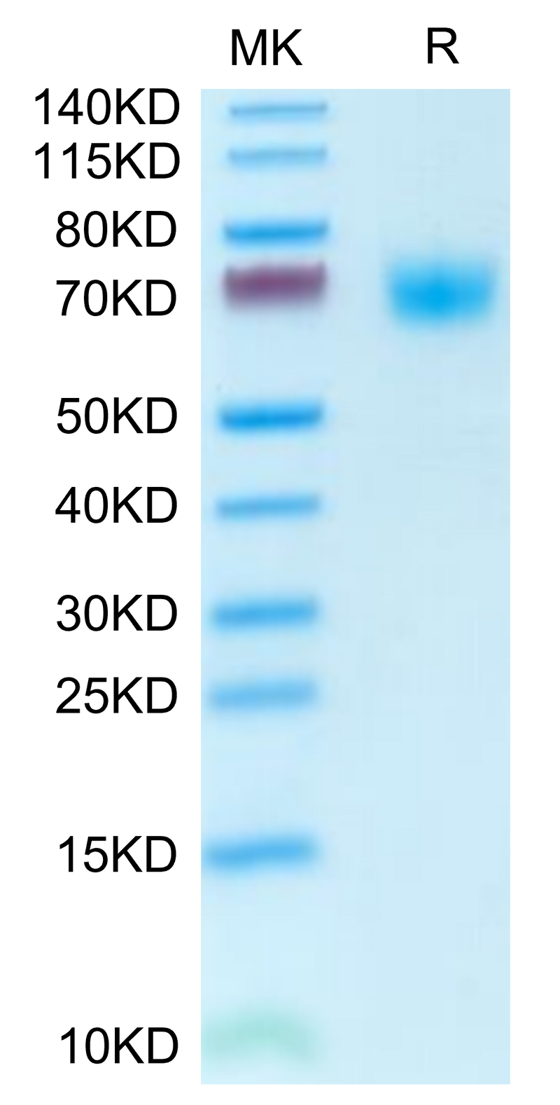 Mouse PLD4 on Tris-Bis PAGE under reduced condition. The purity is greater than 95%.Recombinant Mouse PLD4 Protein