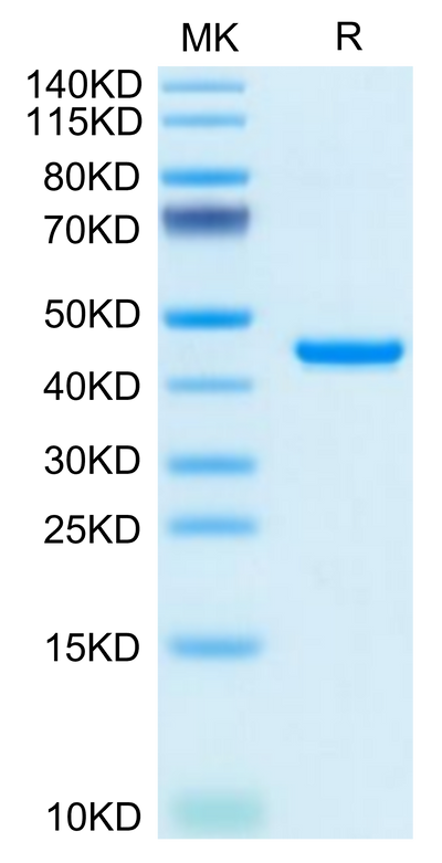 Mouse RETN on Tris-Bis PAGE under reduced condition. The purity is greater than 95%.Recombinant Mouse RETN Protein