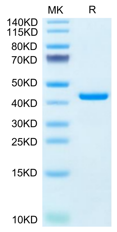 Human RETN on Tris-Bis PAGE under reduced condition. The purity is greater than 95%.Recombinant Human RETN Protein