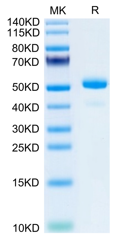 Mouse NGAL/Lipocalin-2 on Tris-Bis PAGE under reduced condition. The purity is greater than 95%.Recombinant Mouse NGAL/Lipocalin-2 Protein