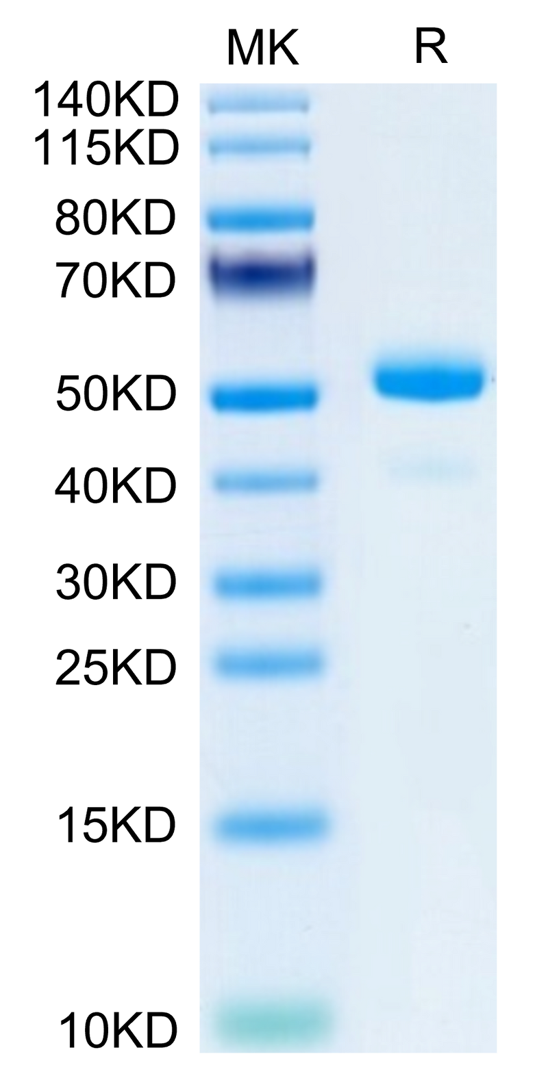 Mouse NGAL/Lipocalin-2 on Tris-Bis PAGE under reduced condition. The purity is greater than 95%.Recombinant Mouse NGAL/Lipocalin-2 Protein