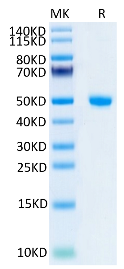 Human NGAL on Tris-Bis PAGE under reduced condition. The purity is greater than 95%.Recombinant Human NGAL/Lipocalin-2 Protein, Active