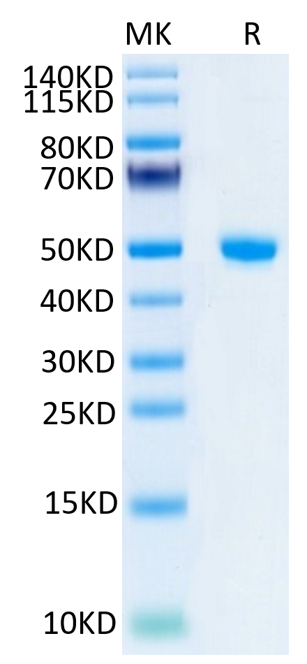 Human NGAL on Tris-Bis PAGE under reduced condition. The purity is greater than 95%.Recombinant Human NGAL/Lipocalin-2 Protein, Active