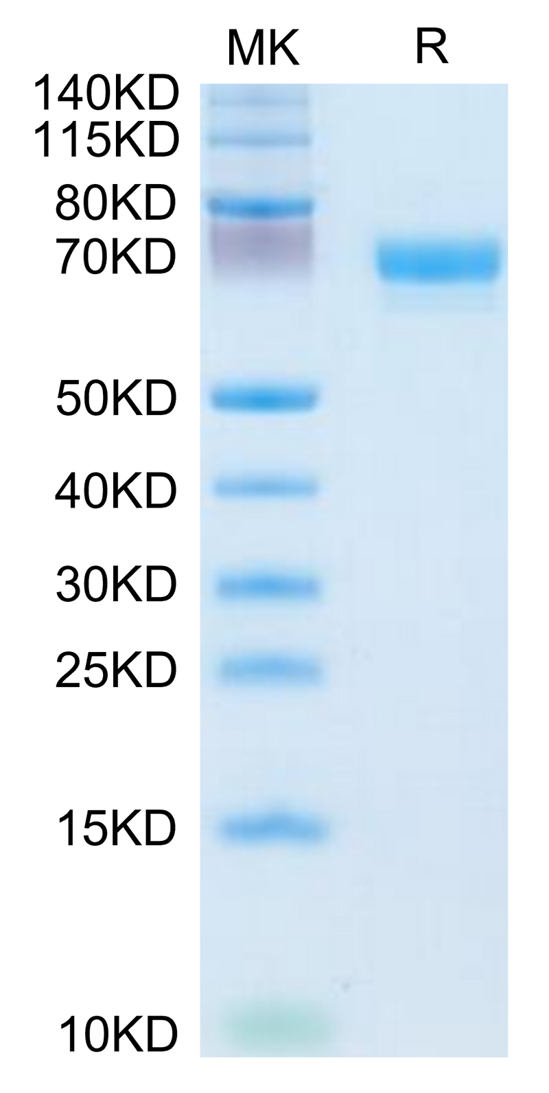 Human EPHA4 on Tris-Bis PAGE under reduced condition. The purity is greater than 95%.Recombinant Human EPHA4 Protein