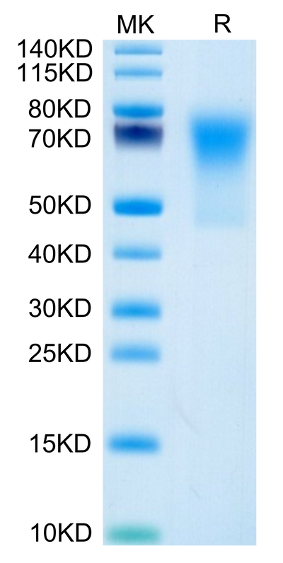 Human DcR1/TRAILR3 on Tris-Bis PAGE under reduced condition. The purity is greater than 95%.Recombinant Human DcR1/TRAILR3 Protein, Active