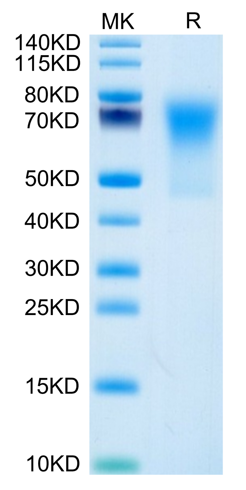 Human DcR1/TRAILR3 on Tris-Bis PAGE under reduced condition. The purity is greater than 95%.Recombinant Human DcR1/TRAILR3 Protein, Active