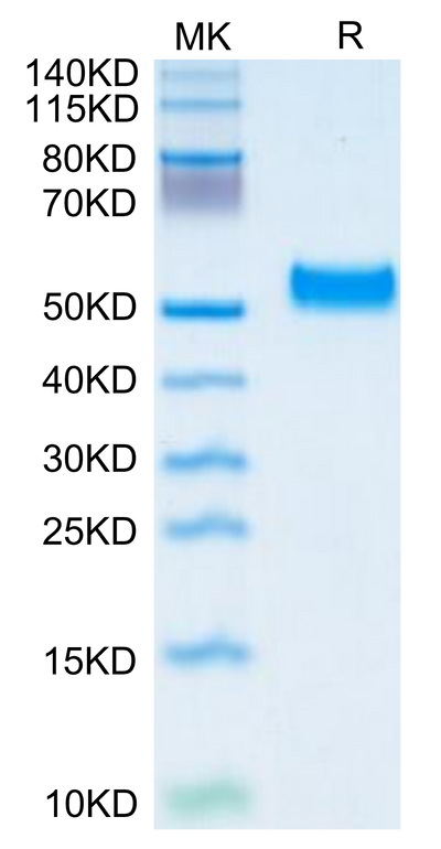 Human Serpin F1/PEDF on Tris-Bis PAGE under reduced condition. The purity is greater than 95%.Recombinant Human Serpin F1/PEDF Protein