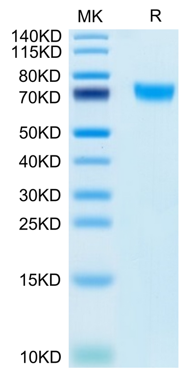 Human PLD4 on Tris-Bis PAGE under reduced condition. The purity is greater than 95%.Recombinant Human PLD4 Protein
