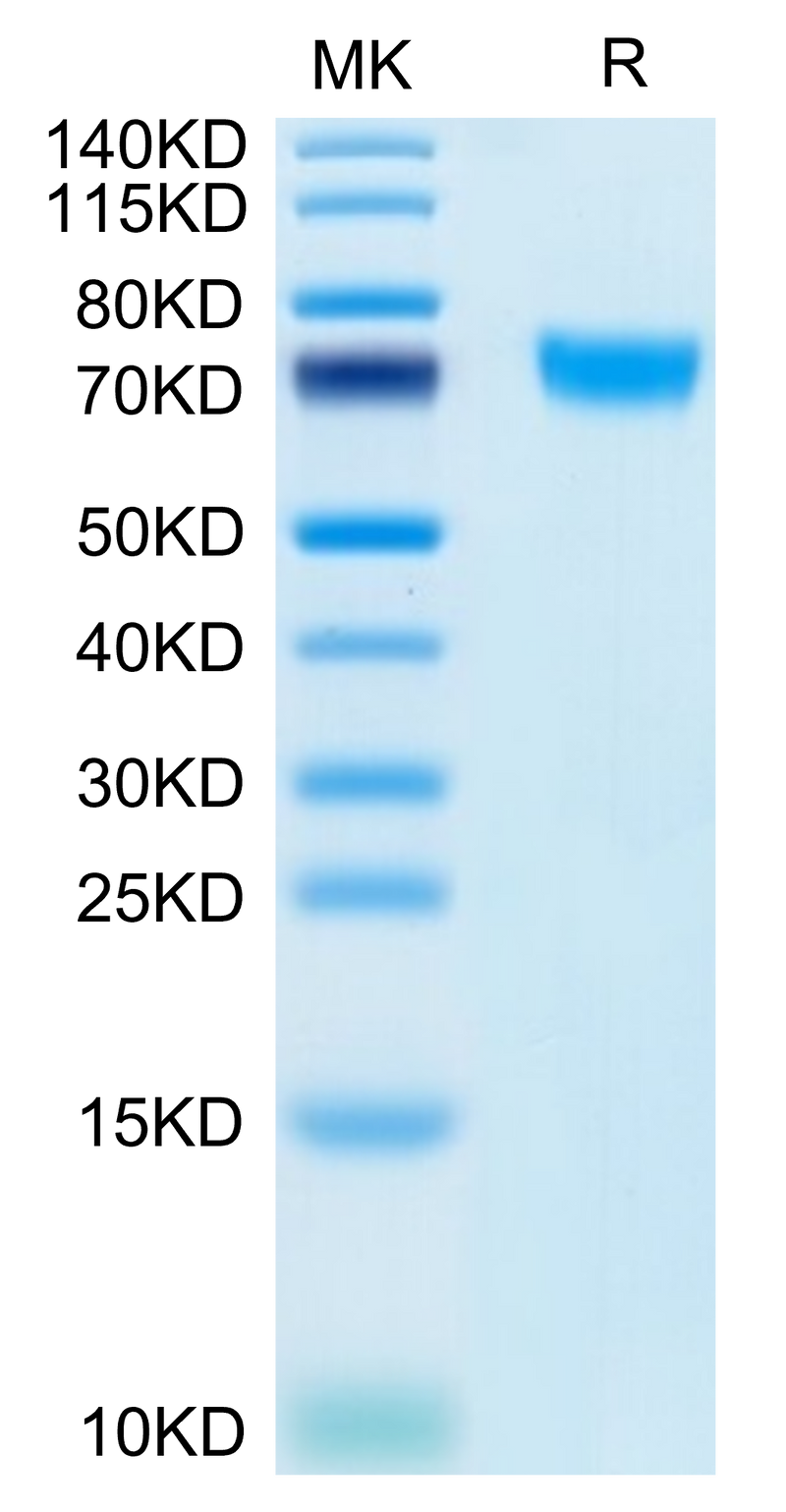 Human PLD4 on Tris-Bis PAGE under reduced condition. The purity is greater than 95%.Recombinant Human PLD4 Protein