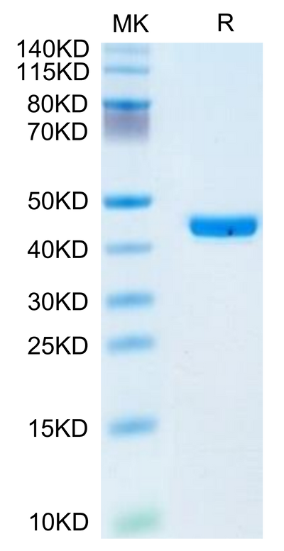 Human YKL-40 on Tris-Bis PAGE under reduced condition. The purity is greater than 95%.Recombinant Human YKL-40/CHI3L1 Protein, Active