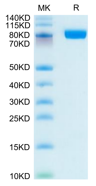 Human CD10 on Tris-Bis PAGE under reduced condition. The purity is greater than 95%.Recombinant Human CD10/MME Protein