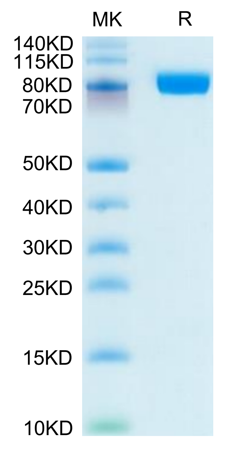 Human CD10 on Tris-Bis PAGE under reduced condition. The purity is greater than 95%.Recombinant Human CD10/MME Protein