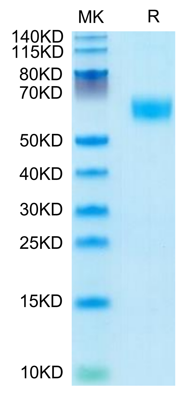 Mouse AMIGO2 on Tris-Bis PAGE under reduced condition. The purity is greater than 95%.Recombinant Mouse AMIGO2 Protein