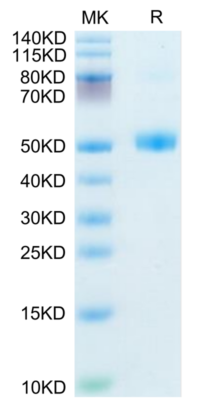 Mouse FSHB on Tris-Bis PAGE under reduced condition. The purity is greater than 95%.Recombinant Mouse FSHB Protein