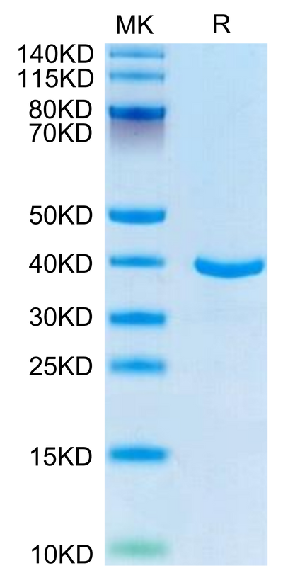 Human ANXA1 on Tris-Bis PAGE under reduced condition. The purity is greater than 95%.Recombinant Human ANXA1 Protein