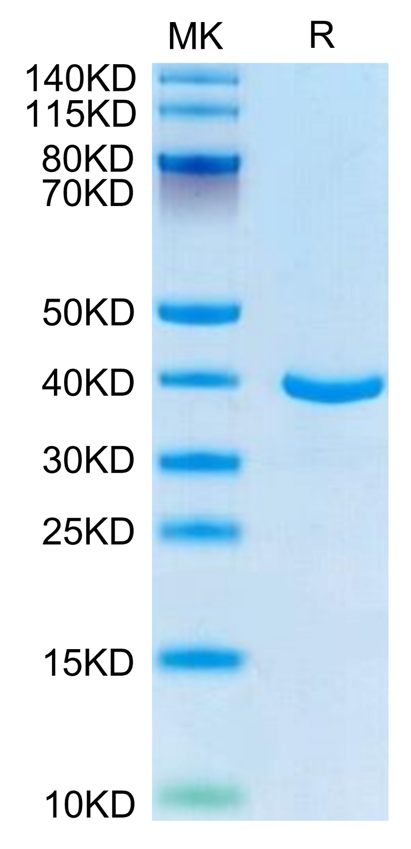 Human ANXA1 on Tris-Bis PAGE under reduced condition. The purity is greater than 95%.Recombinant Human ANXA1 Protein