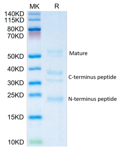 Human RGM-C on Tris-Bis PAGE under reduced condition. The purity is greater than 95%.Recombinant Human RGM-C Protein, Active