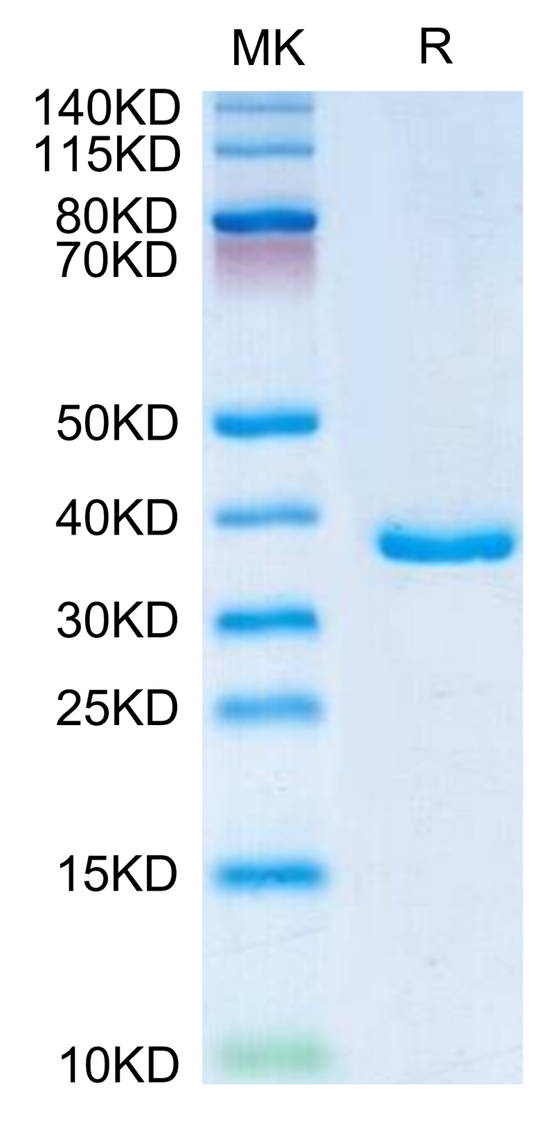 Human IGFBP2 on Tris-Bis PAGE under reduced condition. The purity is greater than 95%.Recombinant Human IGFBP2 Protein