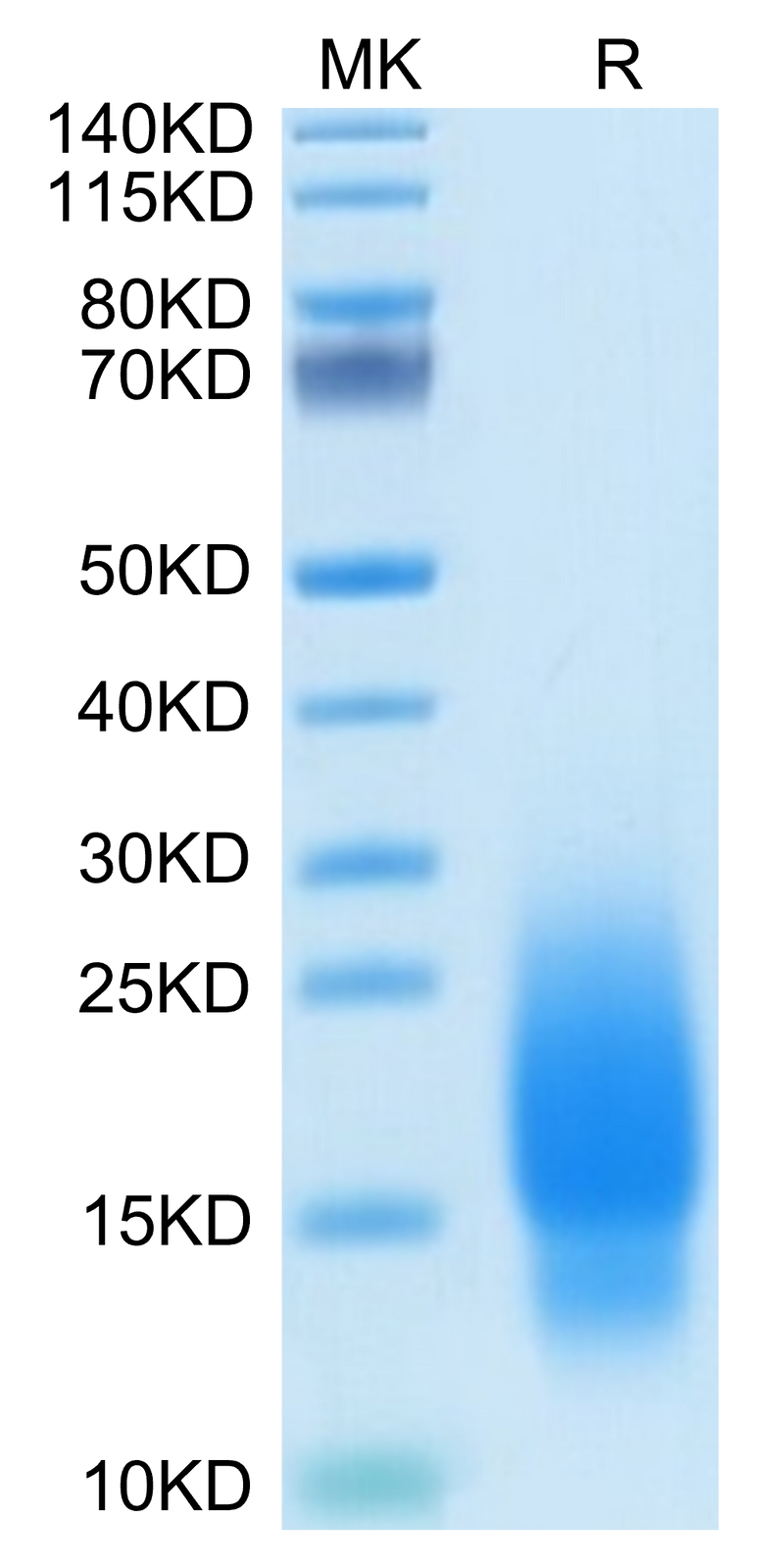 Human GIP on Tris-Bis PAGE under reduced condition. The purity is greater than 95%.Recombinant Human GIP Protein, Active