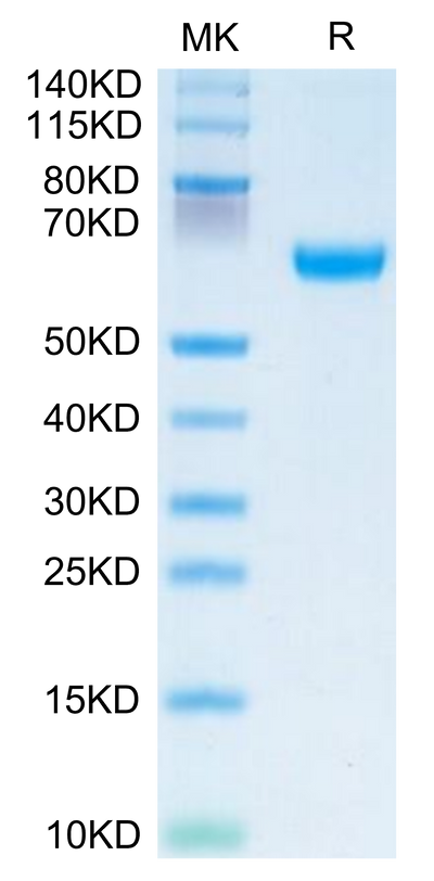 Human OSCAR on Tris-Bis PAGE under reduced condition. The purity is greater than 95%.Recombinant Human OSCAR Protein, Active