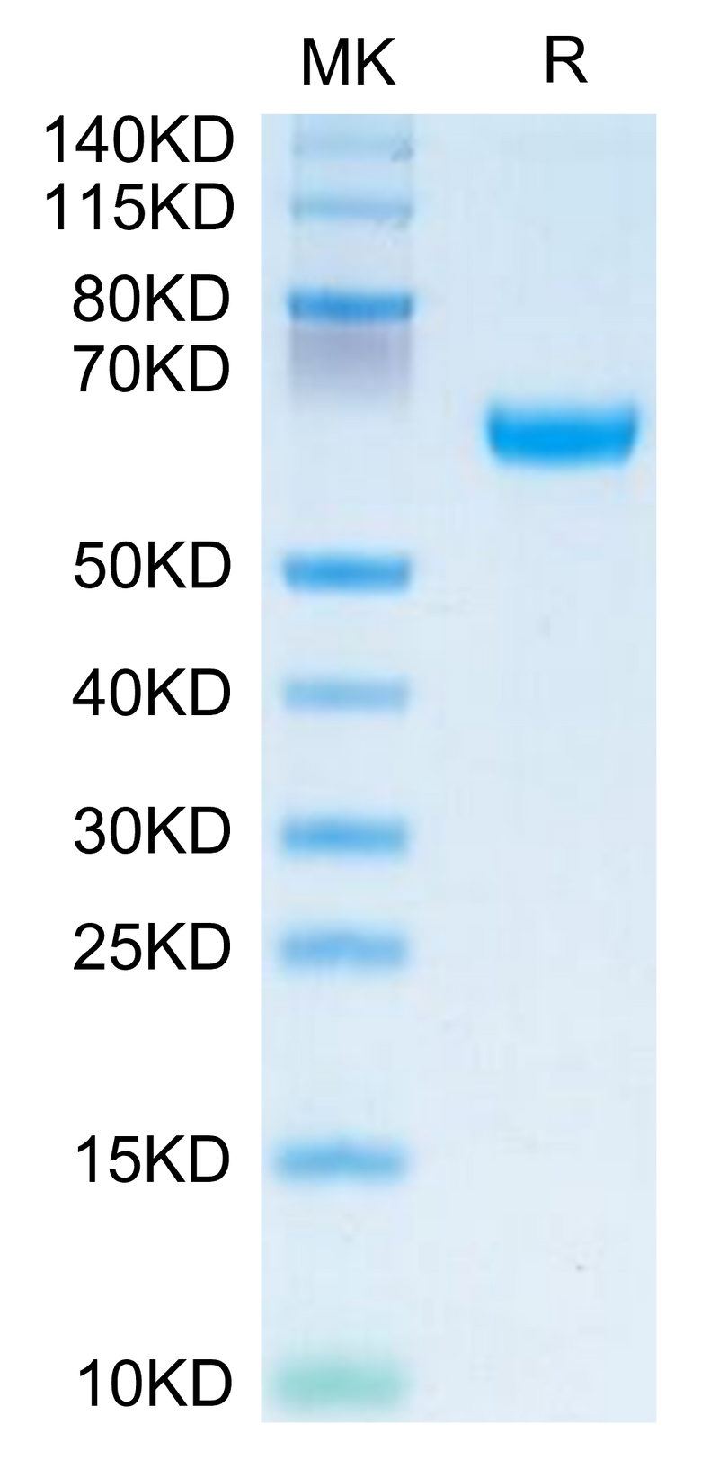 Human OSCAR on Tris-Bis PAGE under reduced condition. The purity is greater than 95%.Recombinant Human OSCAR Protein, Active