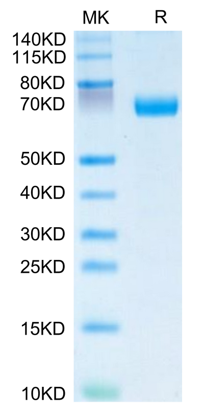 Human IL-20RA on Tris-Bis PAGE under reduced condition. The purity is greater than 95%.Recombinant Human IL-20RA Protein