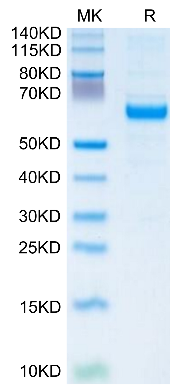 Human IGFBP-3R on Tris-Bis PAGE under reduced condition. The purity is greater than 95%.Recombinant Human IGFBP-3R Protein