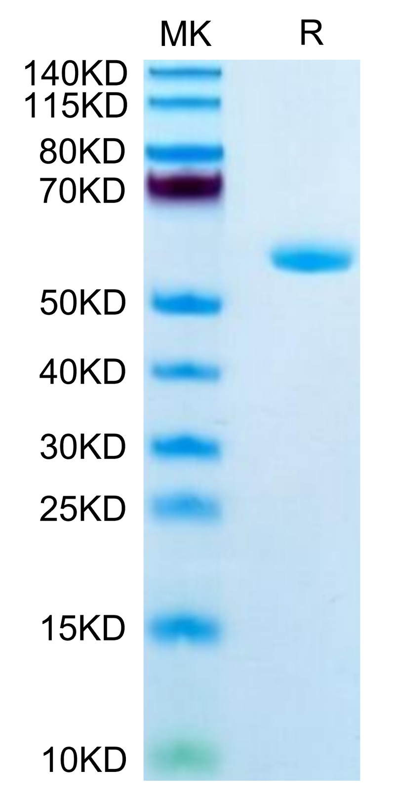 Human APOA1 on Tris-Bis PAGE under reduced condition. The purity is greater than 95%.Recombinant Human APOA1 Protein