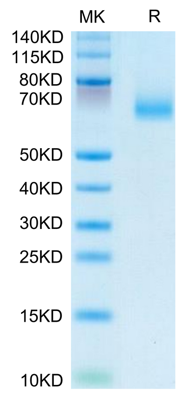 Human EPHA10 on Tris-Bis PAGE under reduced condition. The purity is greater than 95%.Recombinant Human EPHA10 Protein, Active