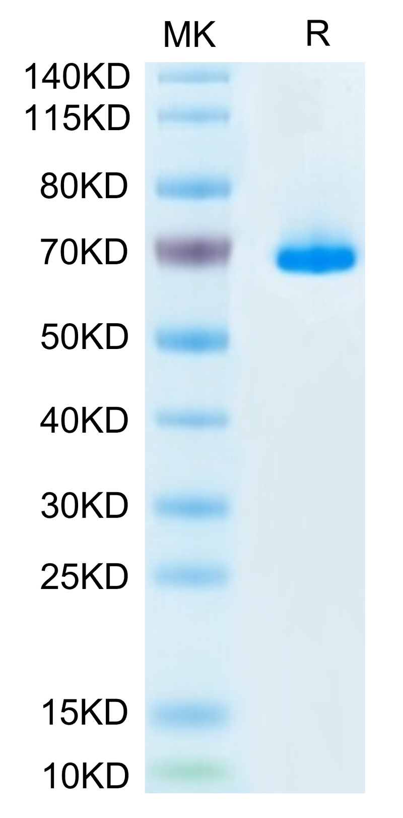 Mouse SEMA3A on Tris-Bis PAGE under reduced condition. The purity is greater than 95%.Recombinant Mouse SEMA3A Protein