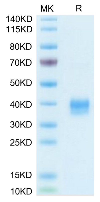 Biotinylated Mouse Siglec-15/CD33L3 on Tris-Bis PAGE under reduced condition. The purity is greater than 95%.Biotinylated Mouse Siglec-15/CD33L3 Protein (Primary Amine Labeling)