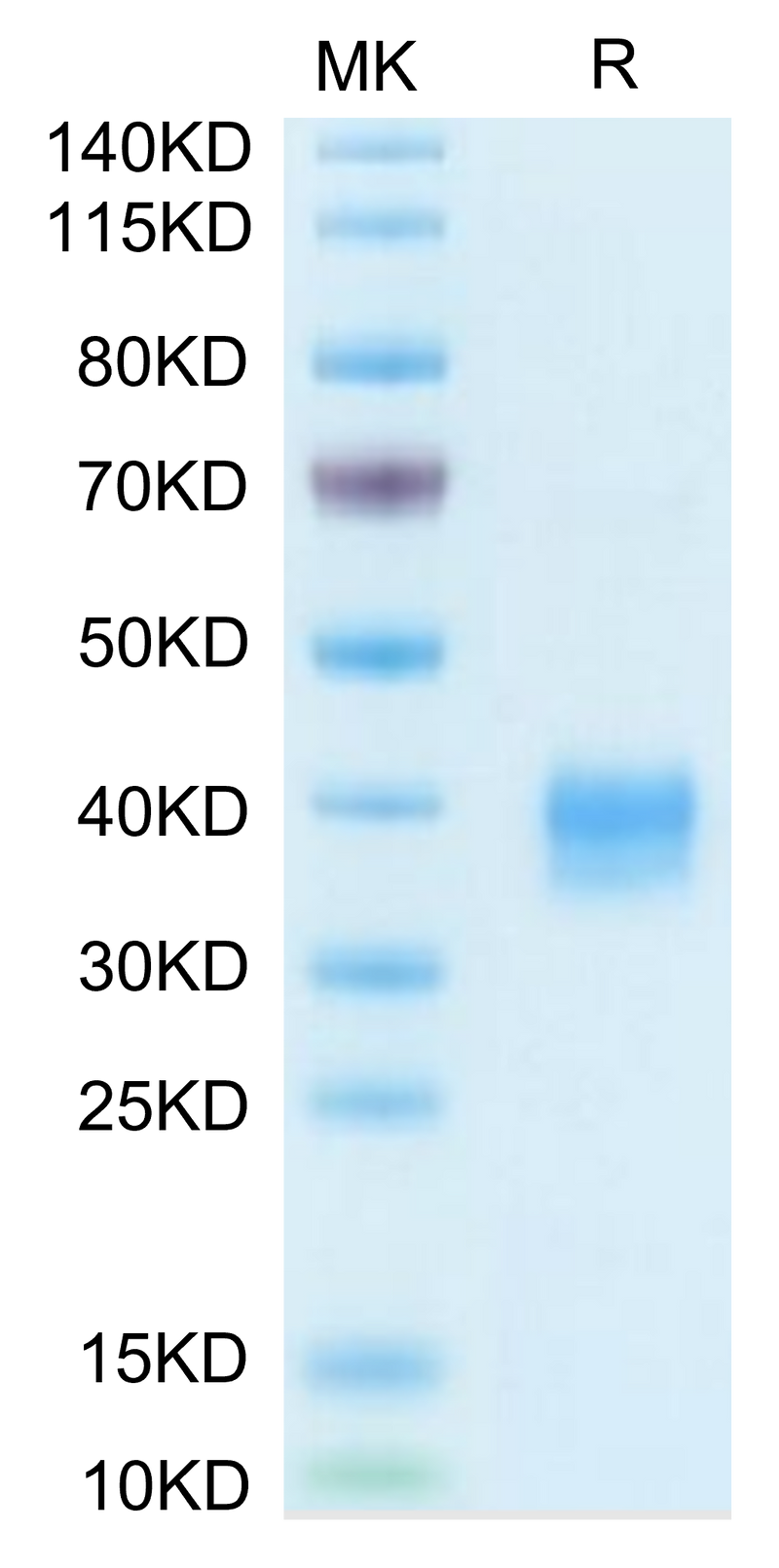 Biotinylated Mouse Siglec-15/CD33L3 on Tris-Bis PAGE under reduced condition. The purity is greater than 95%.Biotinylated Mouse Siglec-15/CD33L3 Protein (Primary Amine Labeling)