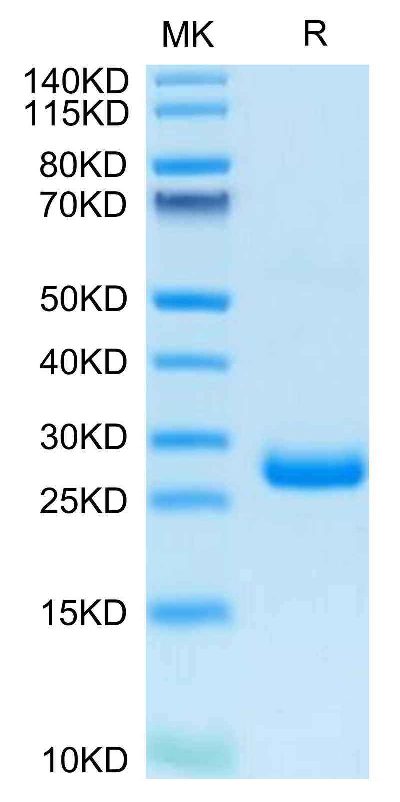 Human BTN3A3/BTF3 on Tris-Bis PAGE under reduced condition. The purity is greater than 95%.Recombinant Human BTN3A3/BTF3 Protein