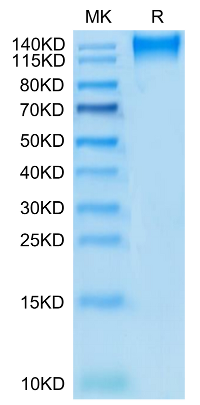 Human CD96 on Tris-Bis PAGE under reduced condition. The purity is greater than 95%.Recombinant Human CD96/TACTILE Protein, Active