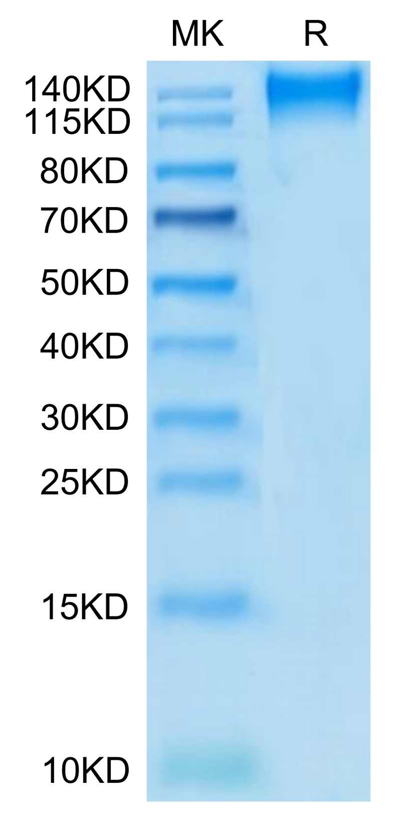 Human CD96 on Tris-Bis PAGE under reduced condition. The purity is greater than 95%.Recombinant Human CD96/TACTILE Protein, Active