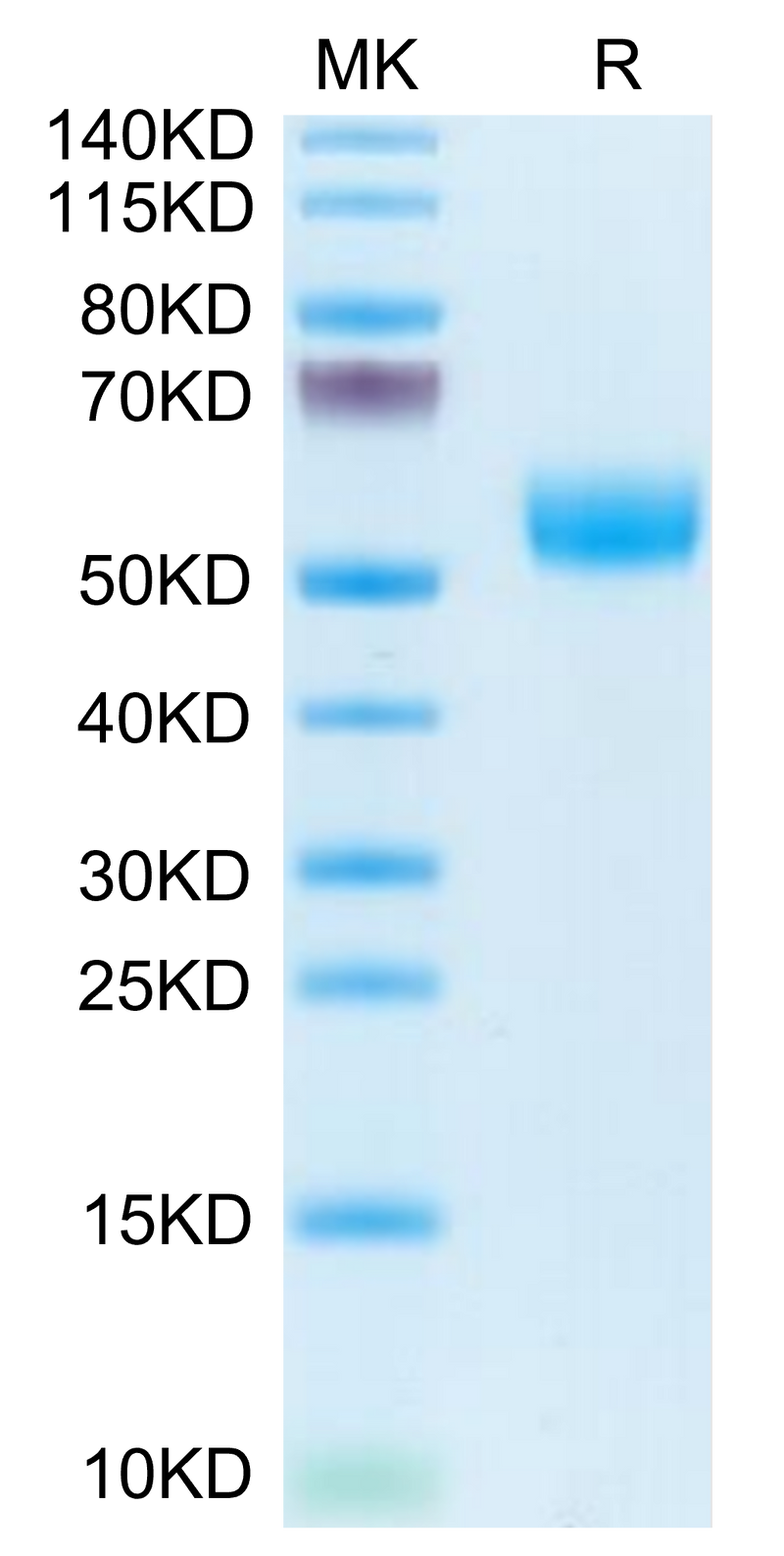 Human APOH on Tris-Bis PAGE under reduced condition. The purity is greater than 95%.Recombinant Human APOH Protein, Active