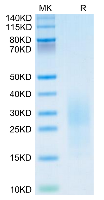 Mouse PSCA on Tris-Bis PAGE under reduced condition. The purity is greater than 95%.Recombinant Mouse PSCA Protein