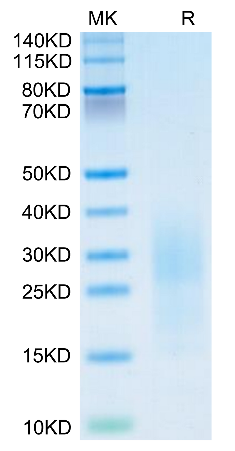 Mouse PSCA on Tris-Bis PAGE under reduced condition. The purity is greater than 95%.Recombinant Mouse PSCA Protein