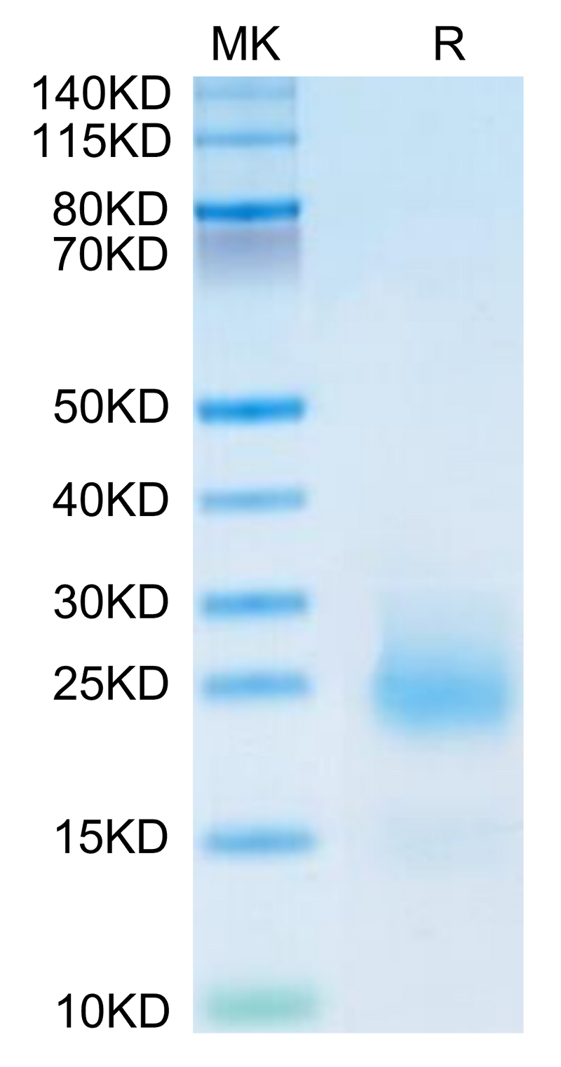 Mouse CCL24 on Tris-Bis PAGE under reduced condition. The purity is greater than 95%.Recombinant Mouse CCL24 Protein