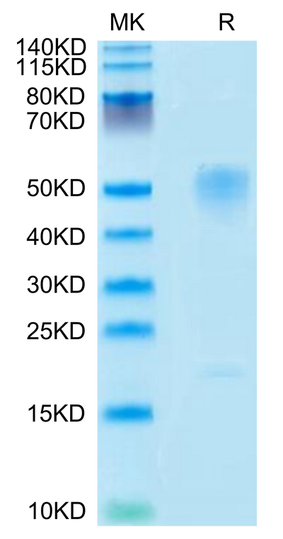 Mouse GPA on Tris-Bis PAGE under reduced condition. The purity is greater than 95%.Recombinant Mouse GPA Protein