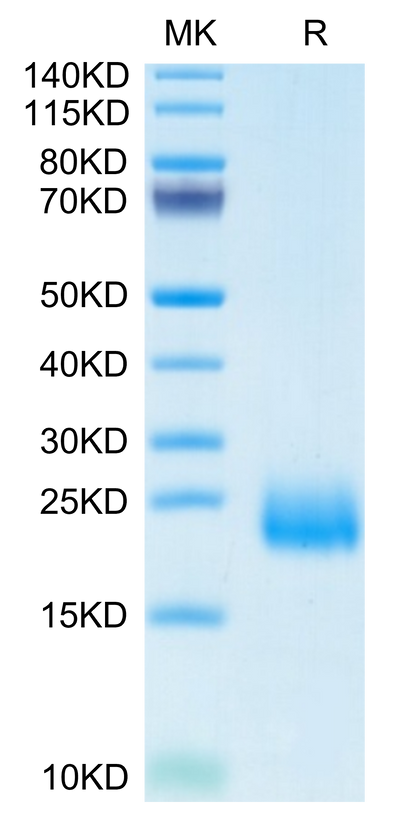 Human CCL24 on Tris-Bis PAGE under reduced condition. The purity is greater than 95%.Recombinant Human CCL24 Protein, Active
