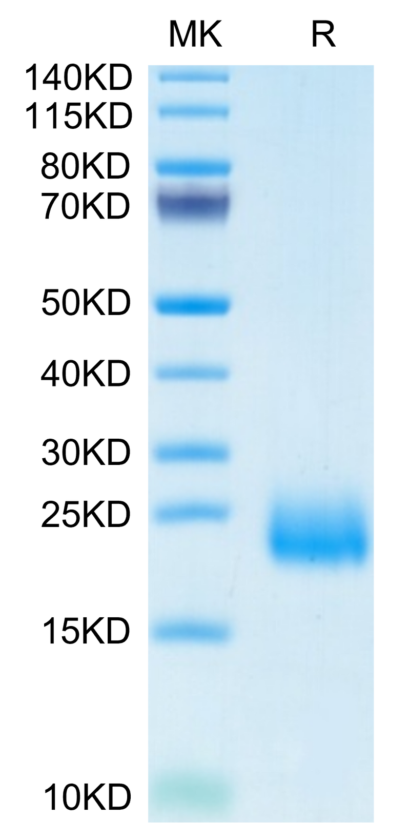 Human CCL24 on Tris-Bis PAGE under reduced condition. The purity is greater than 95%.Recombinant Human CCL24 Protein, Active